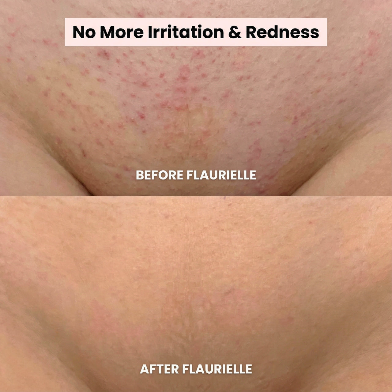 Flaurielle SilkTrim Precision Trimmer