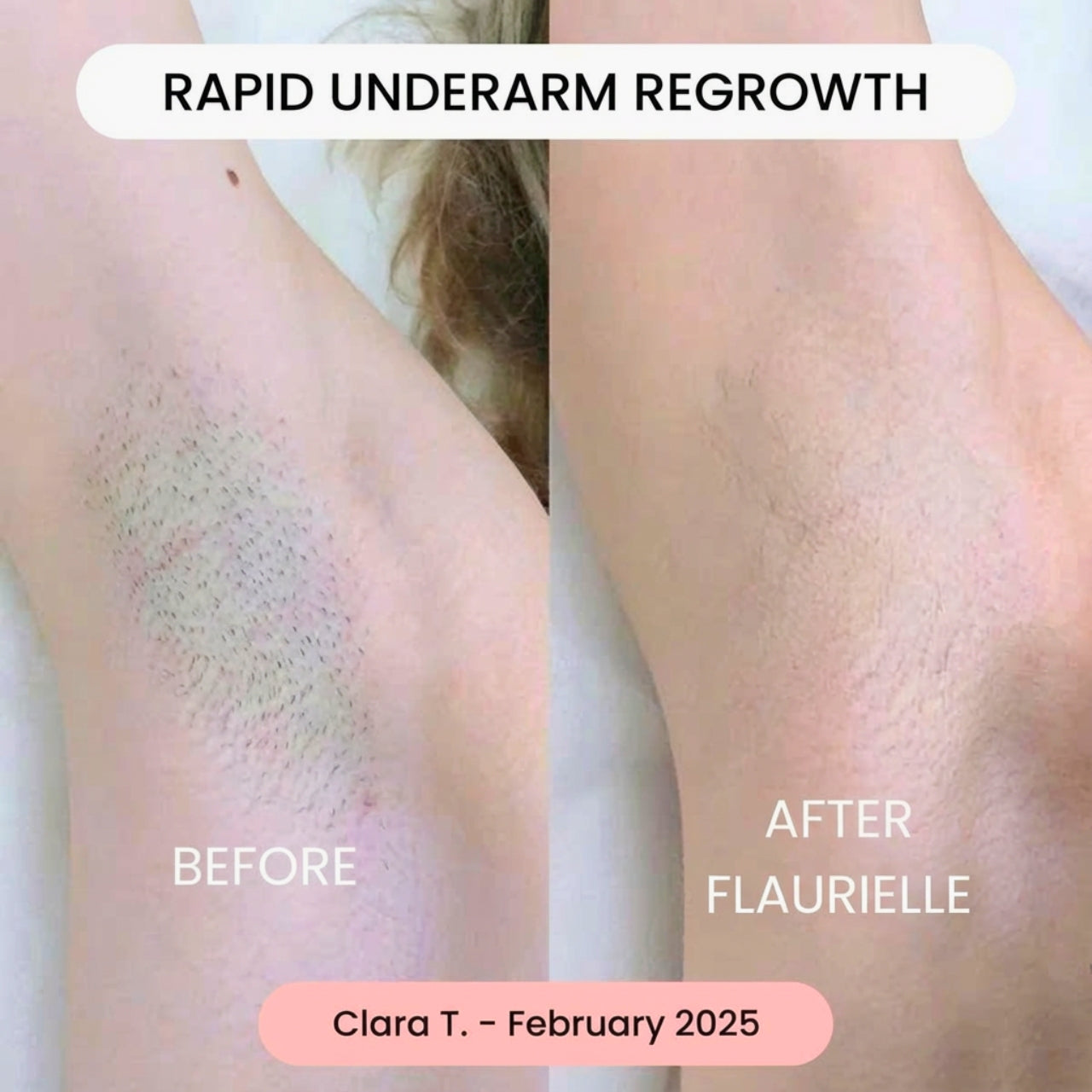 Flaurielle SilkTrim Precision Trimmer